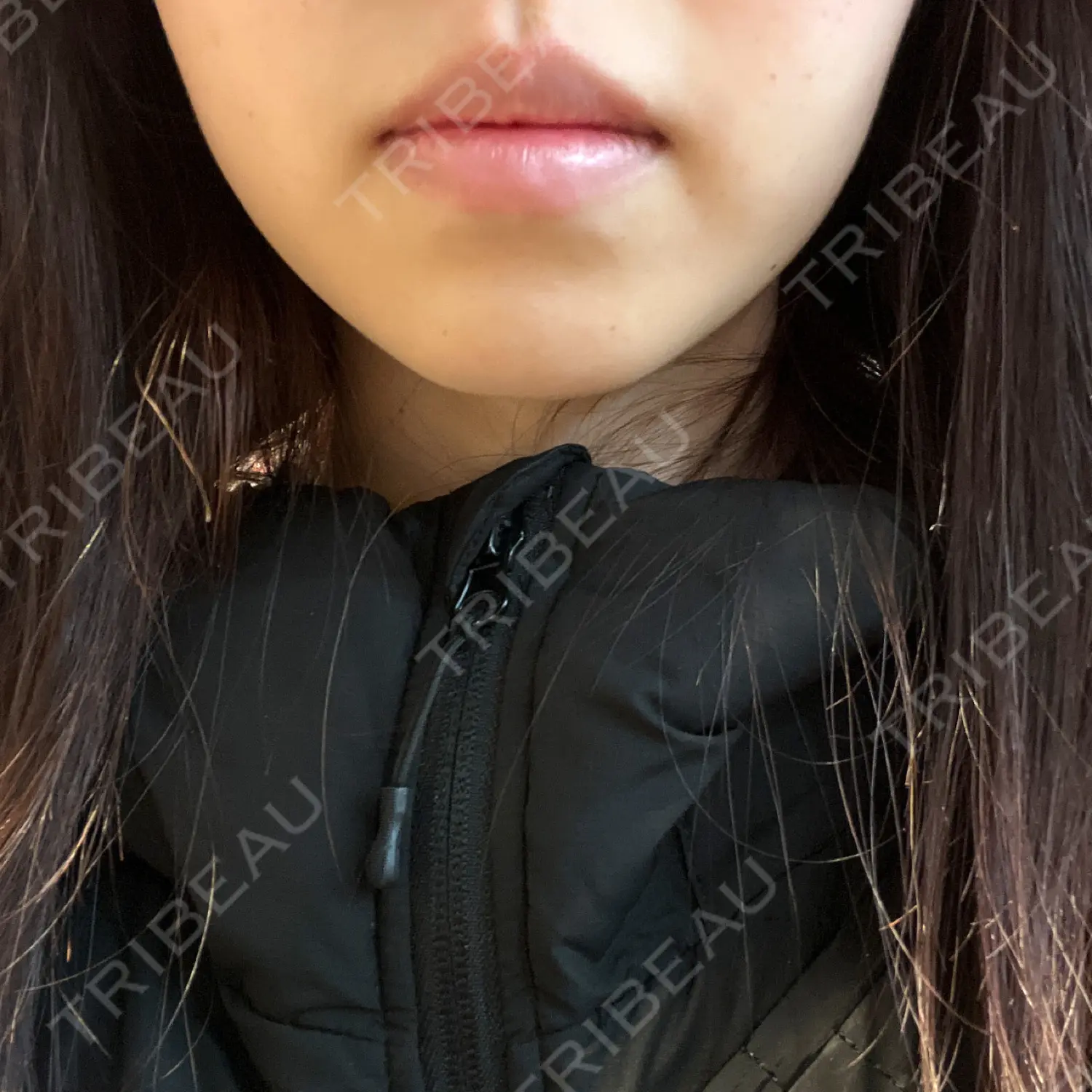 施術前の写真