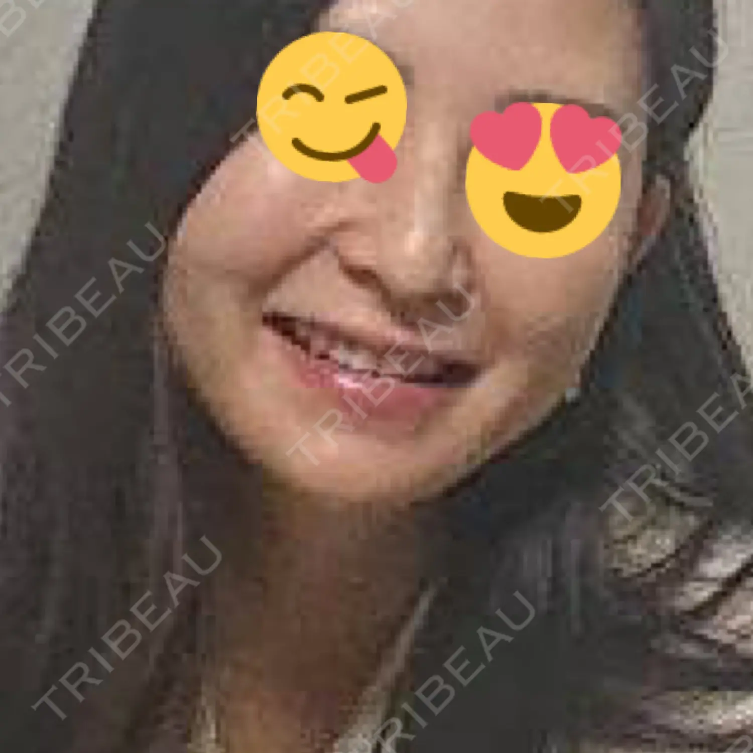 施術前の写真