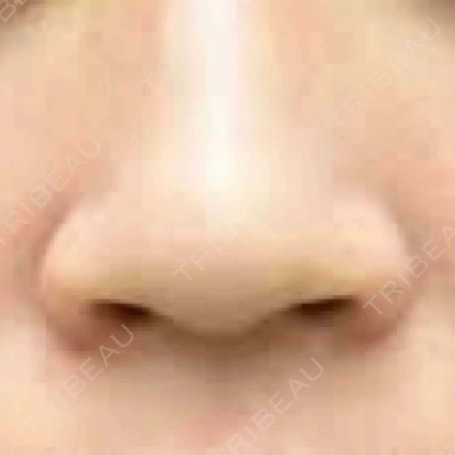施術前の写真