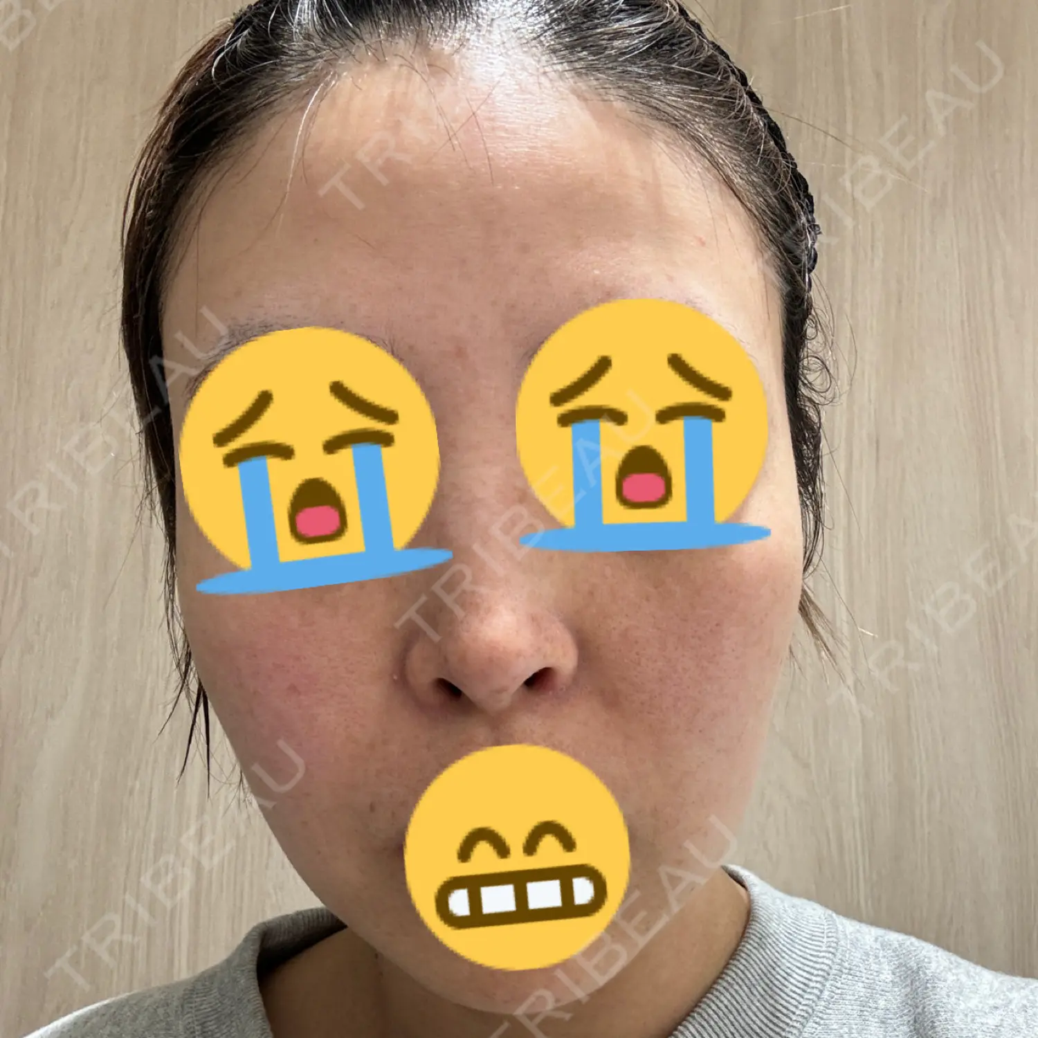 施術前の写真