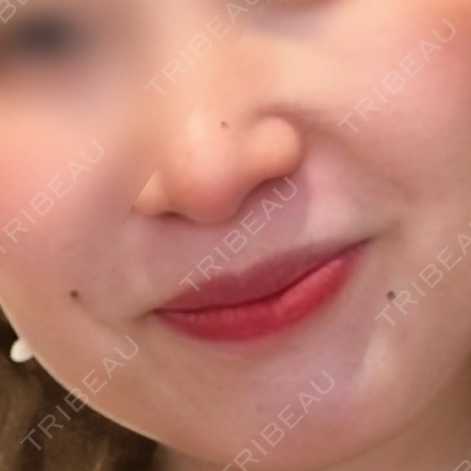 施術前の写真