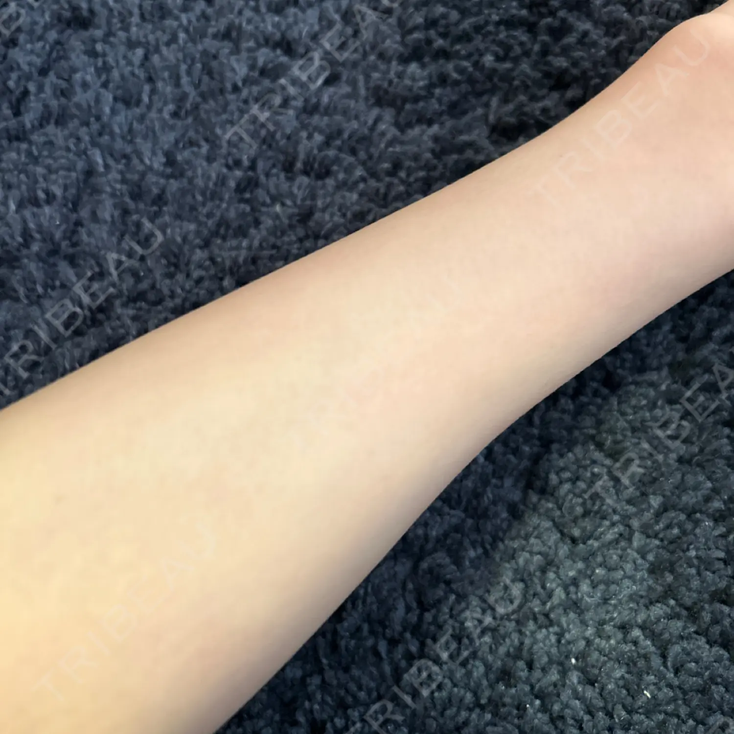 施術前の写真