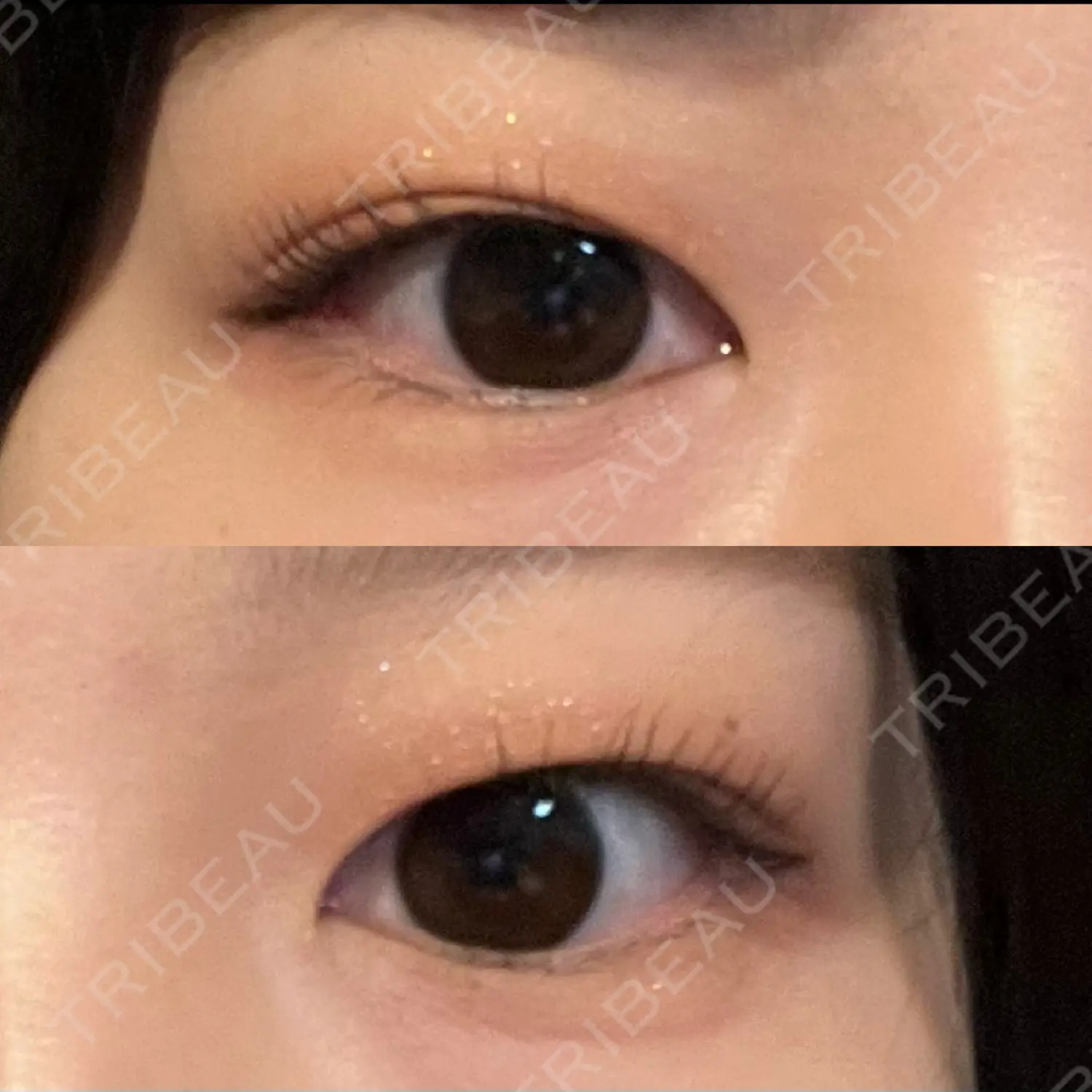 施術前の写真