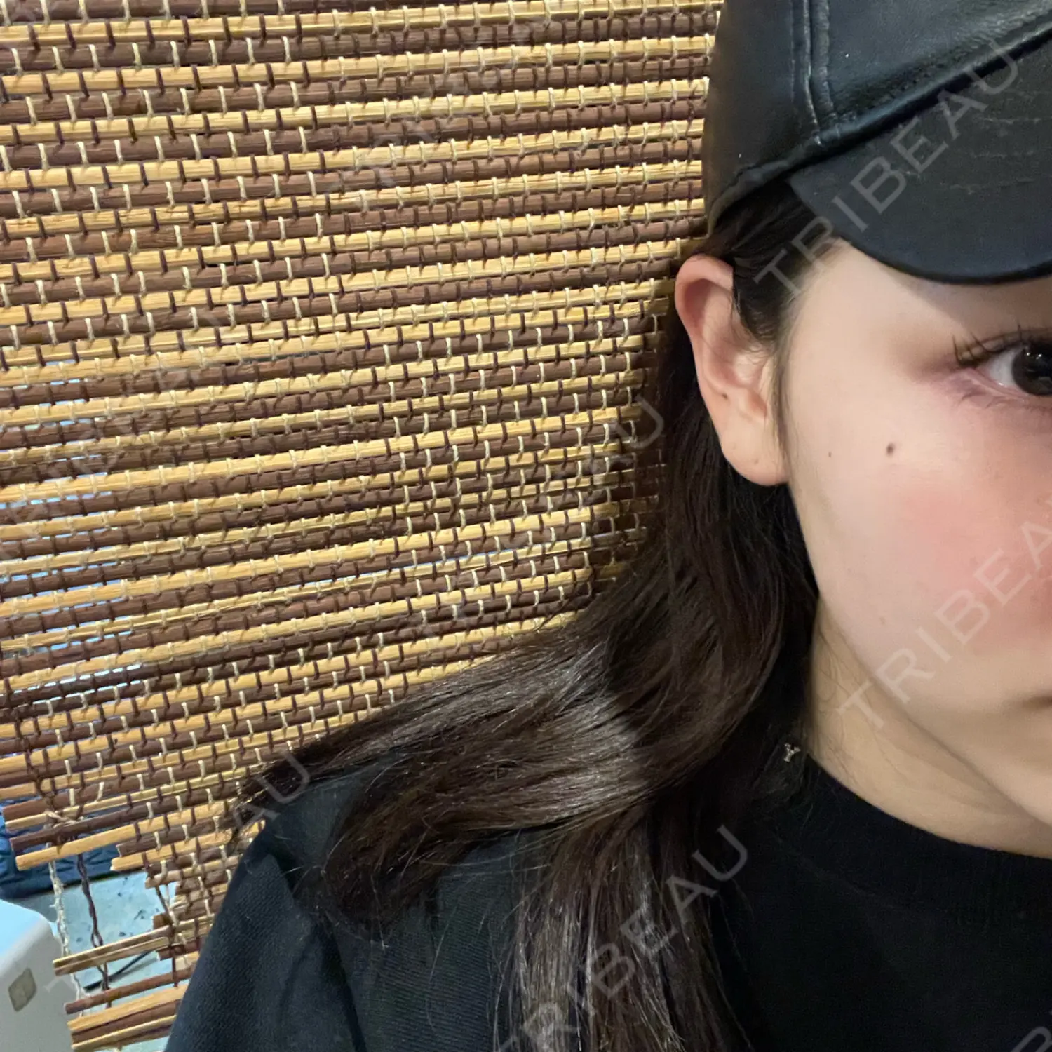 施術前の写真