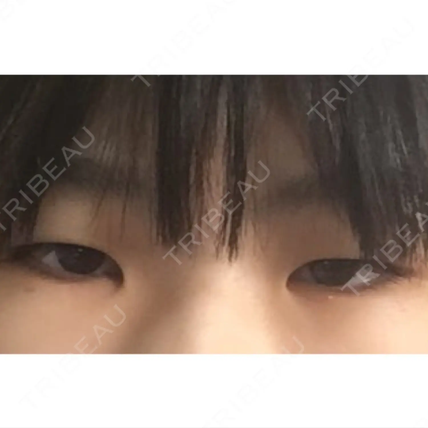 施術前の写真
