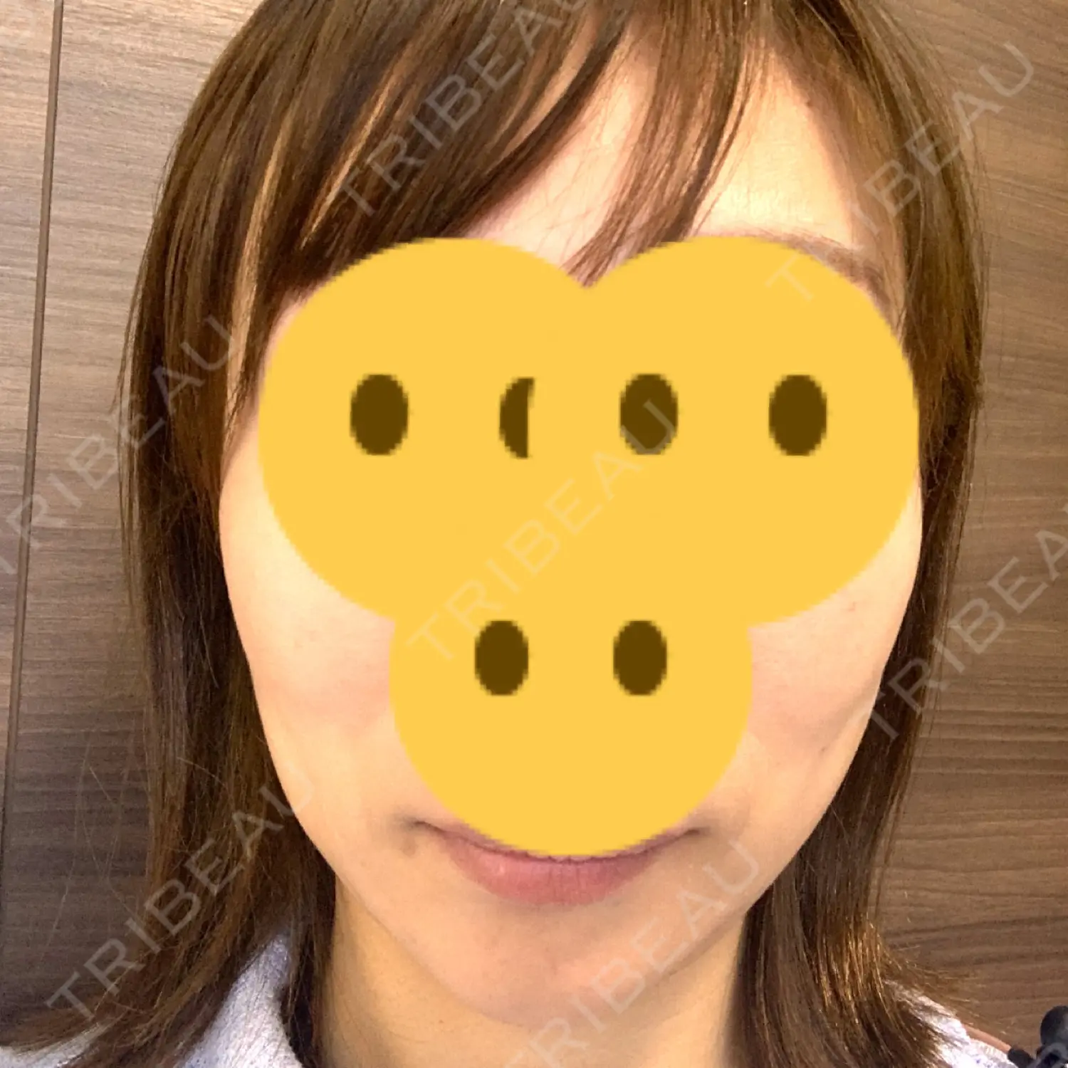 施術前の写真