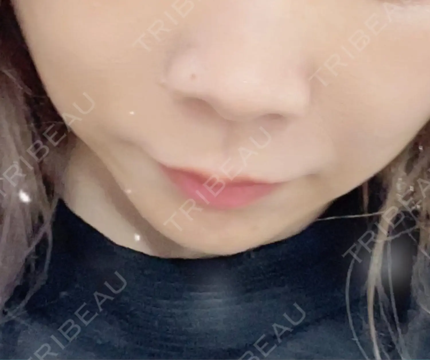 施術前の写真