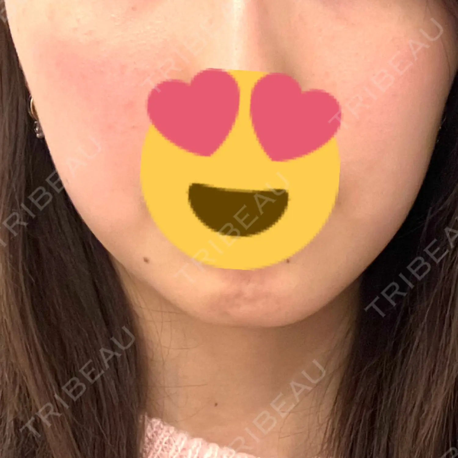施術前の写真