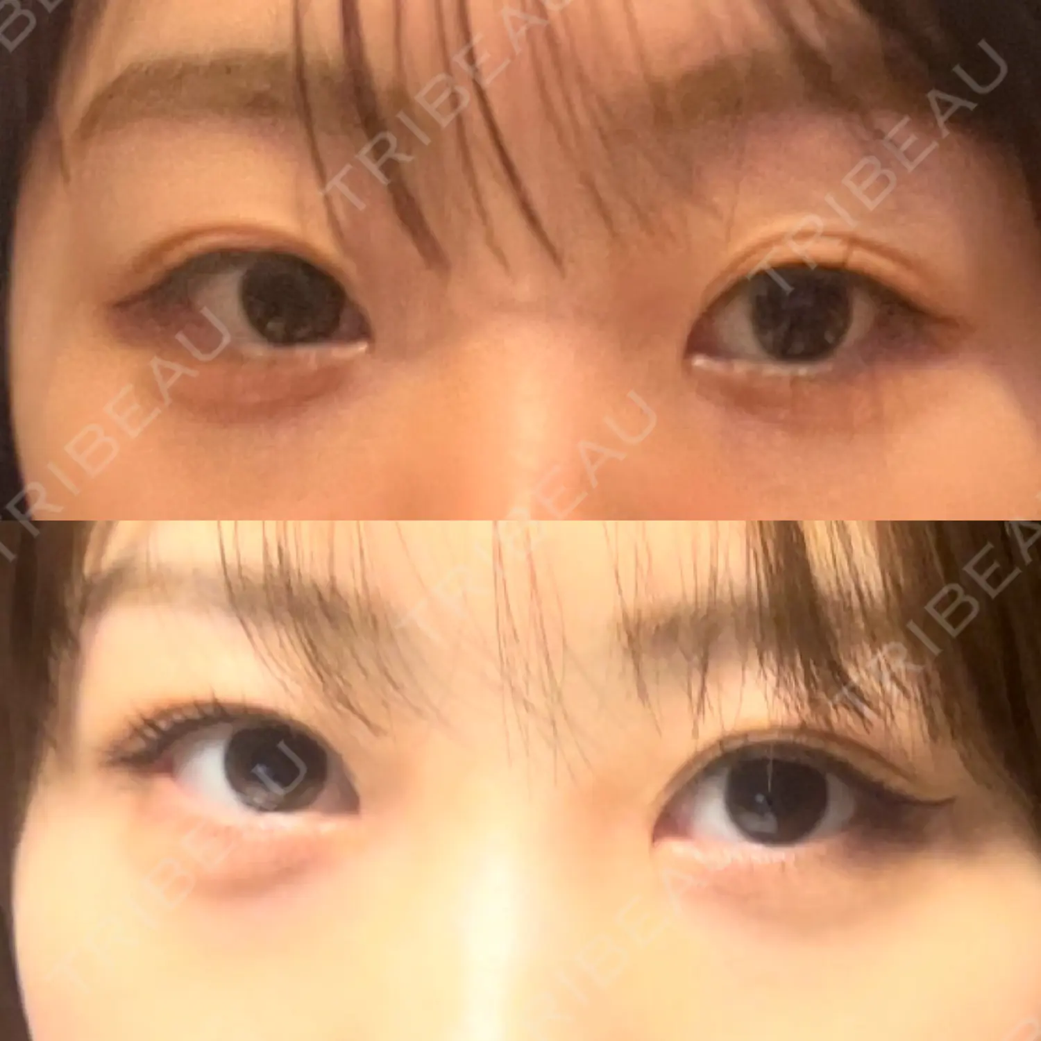 施術前の写真