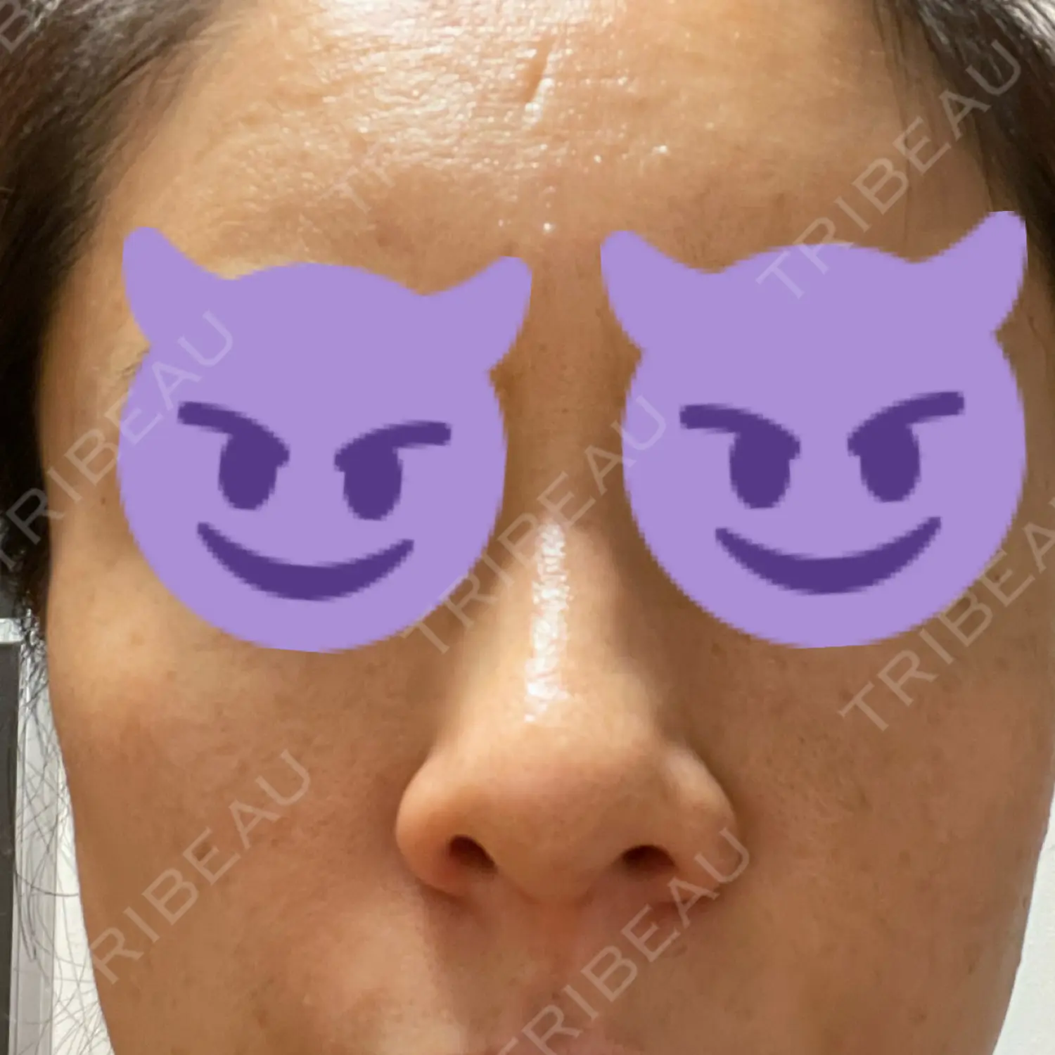 施術前の写真