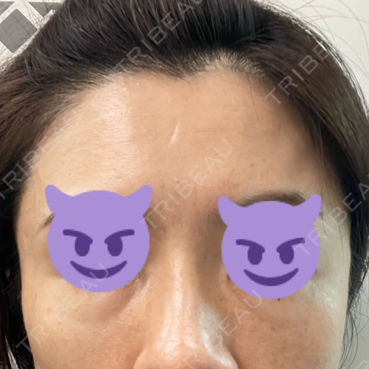 施術前の写真