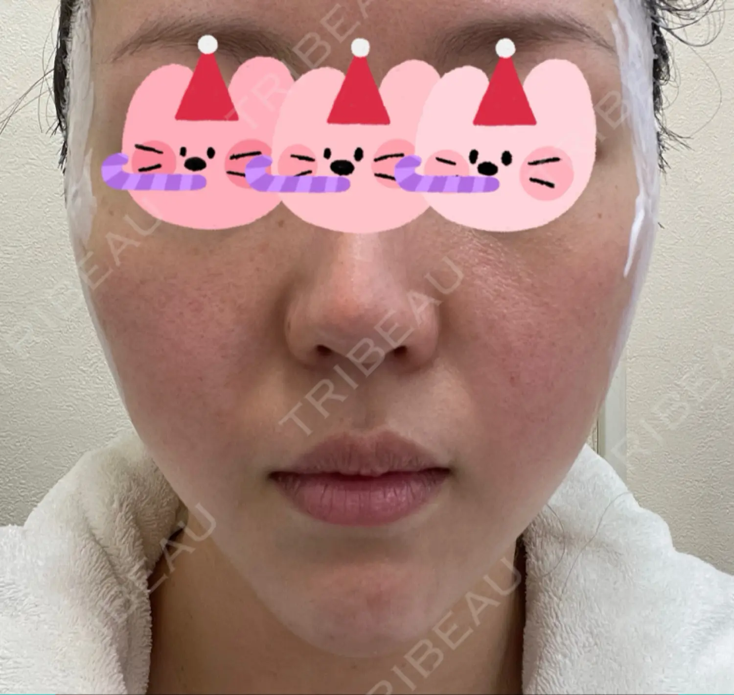 施術前の写真