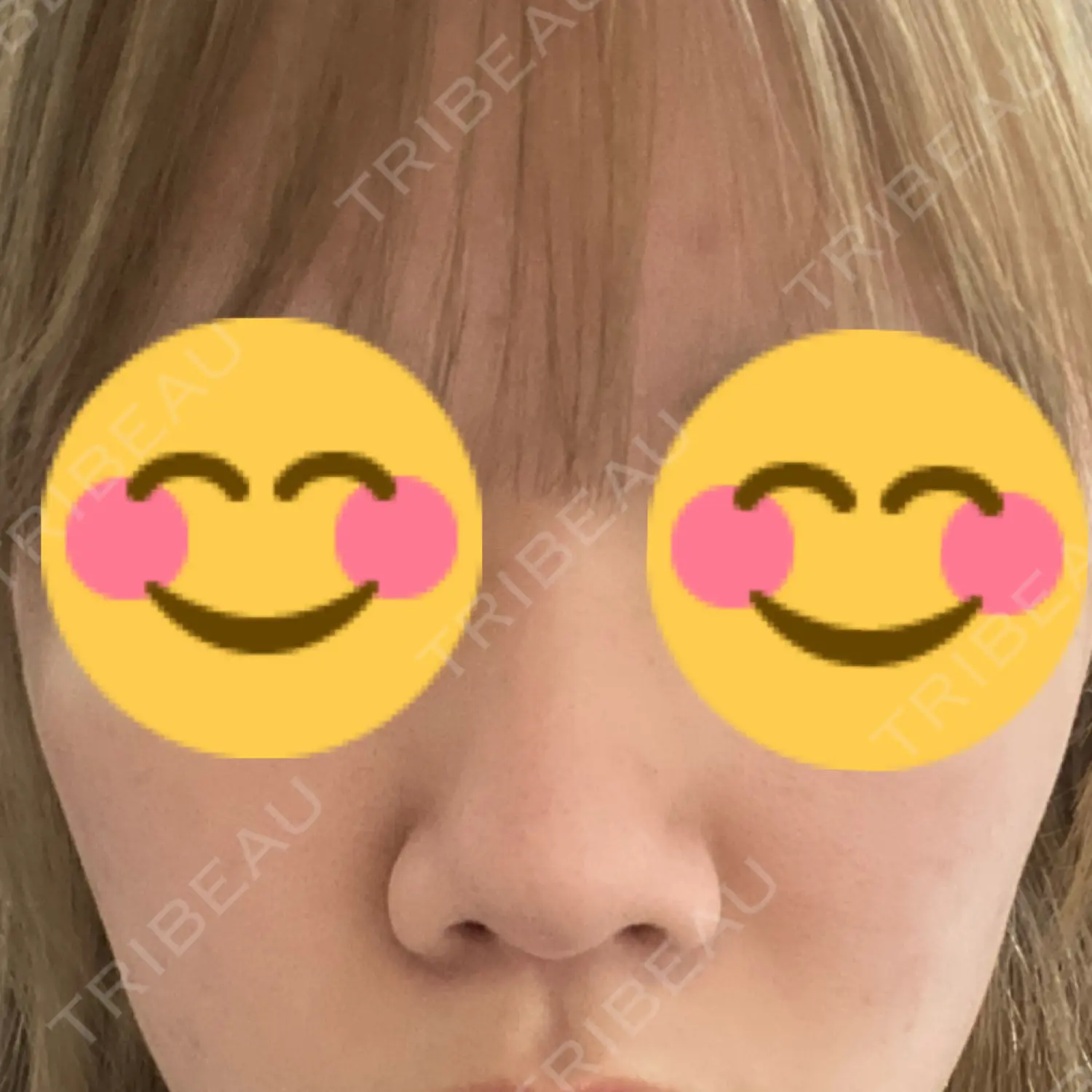施術前の写真