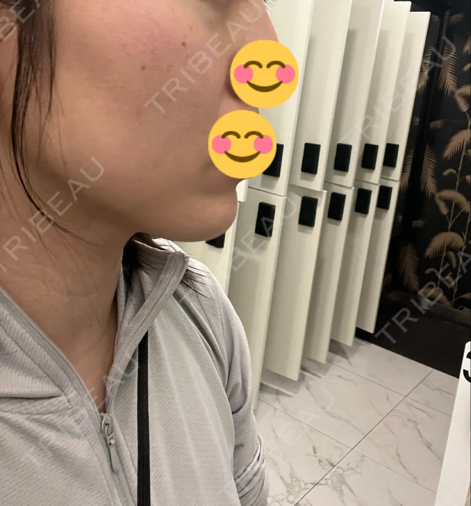 施術前の写真