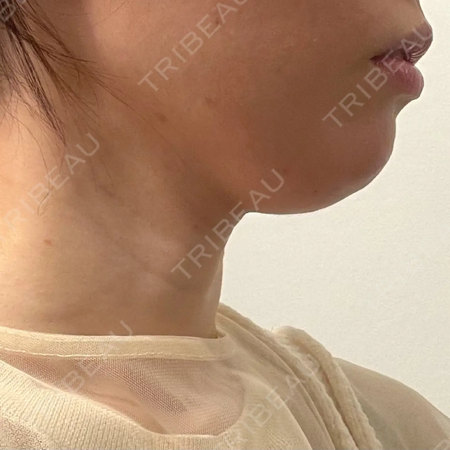 施術前の写真