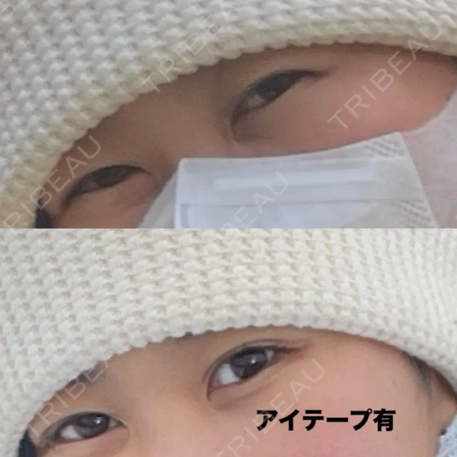 施術前の写真