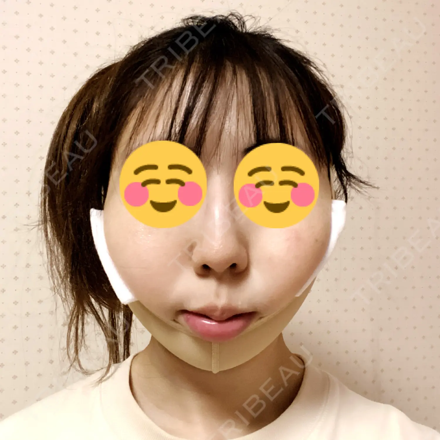 施術前の写真