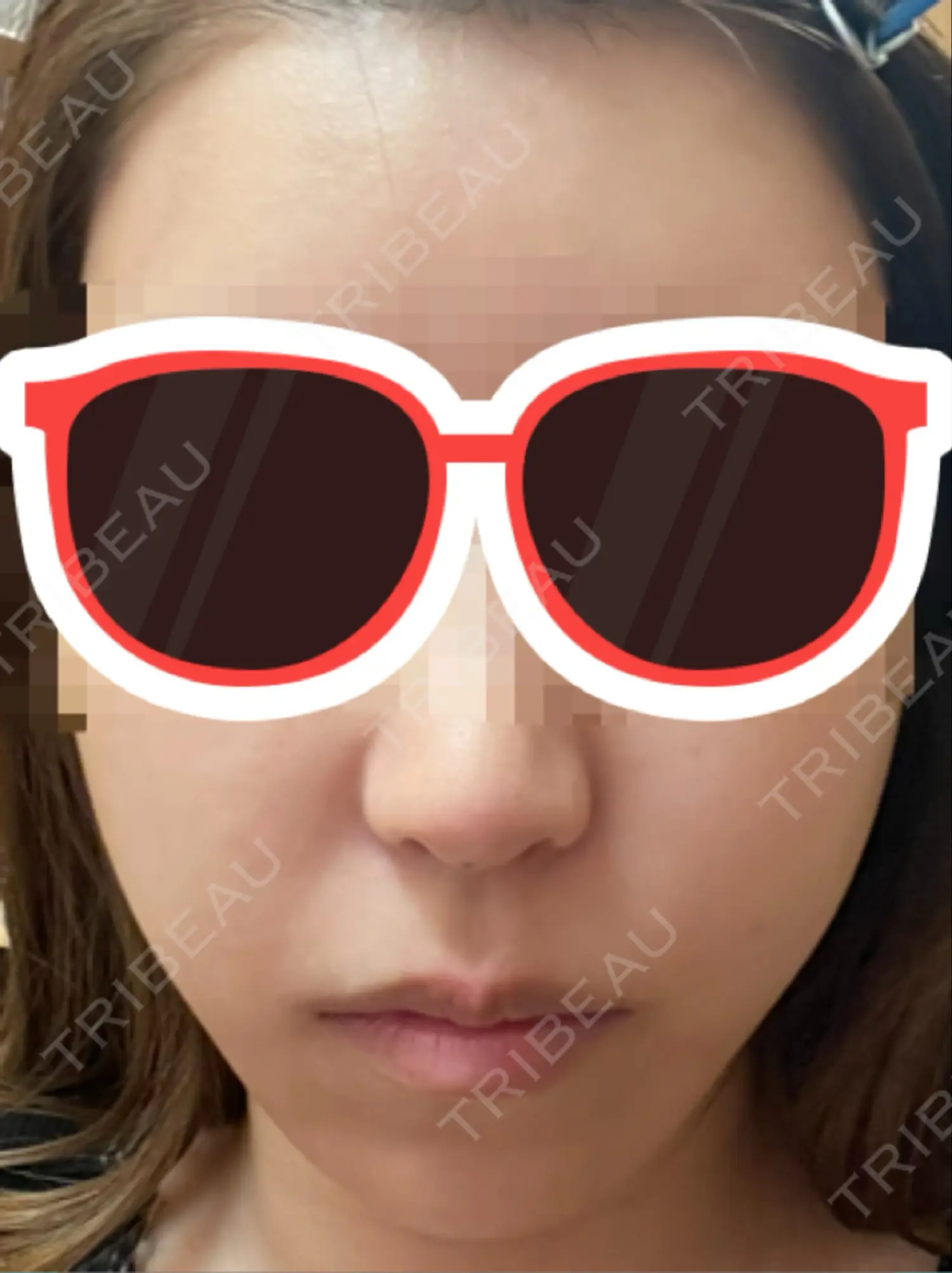 施術前の写真