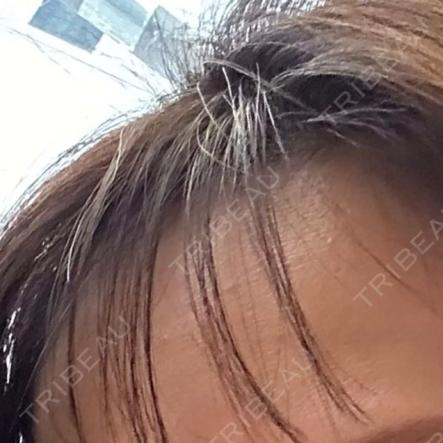 施術前の写真