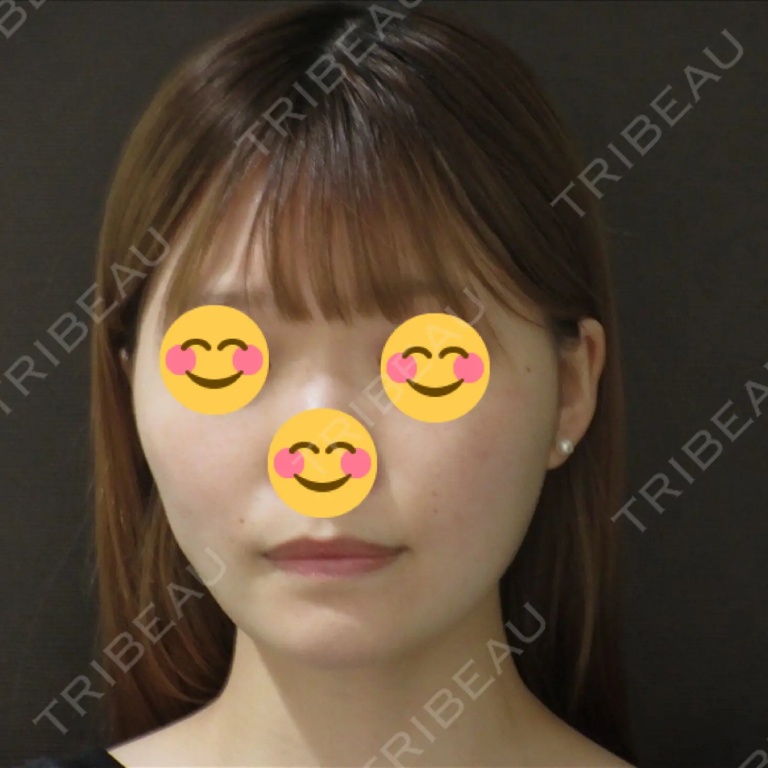 施術前の写真
