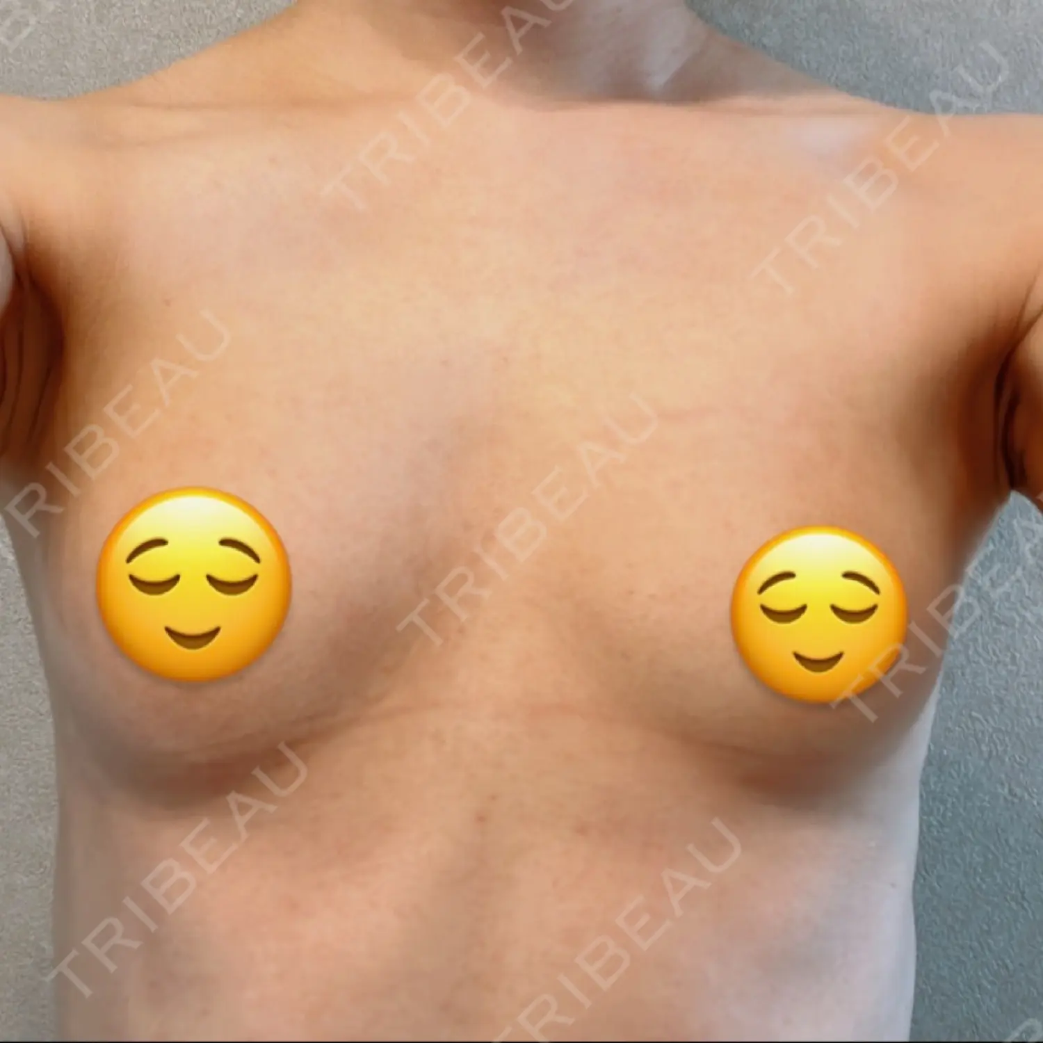 施術前の写真