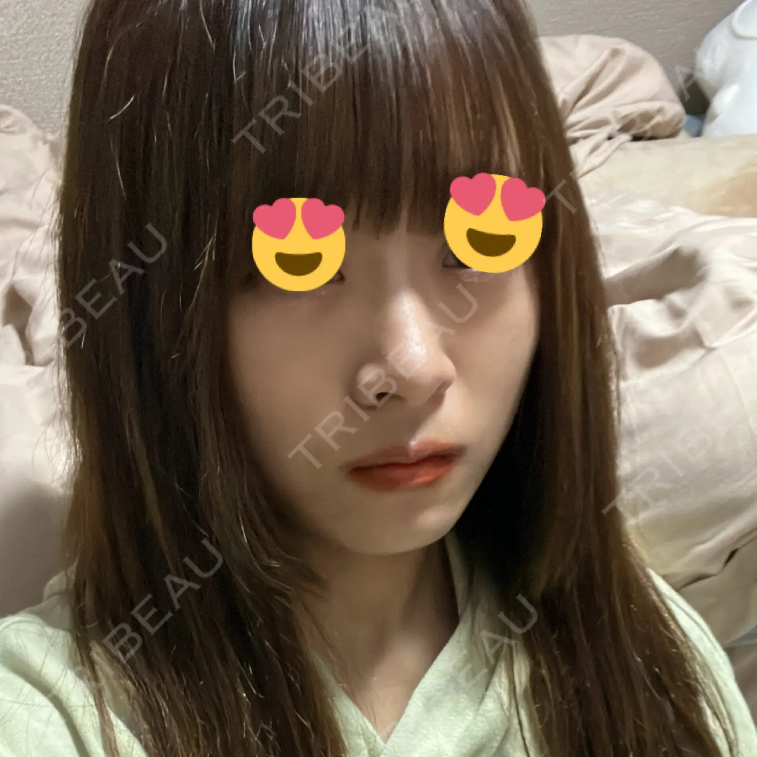 施術前の写真