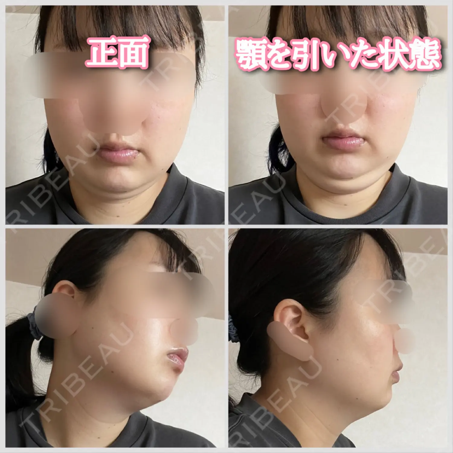 施術前の写真