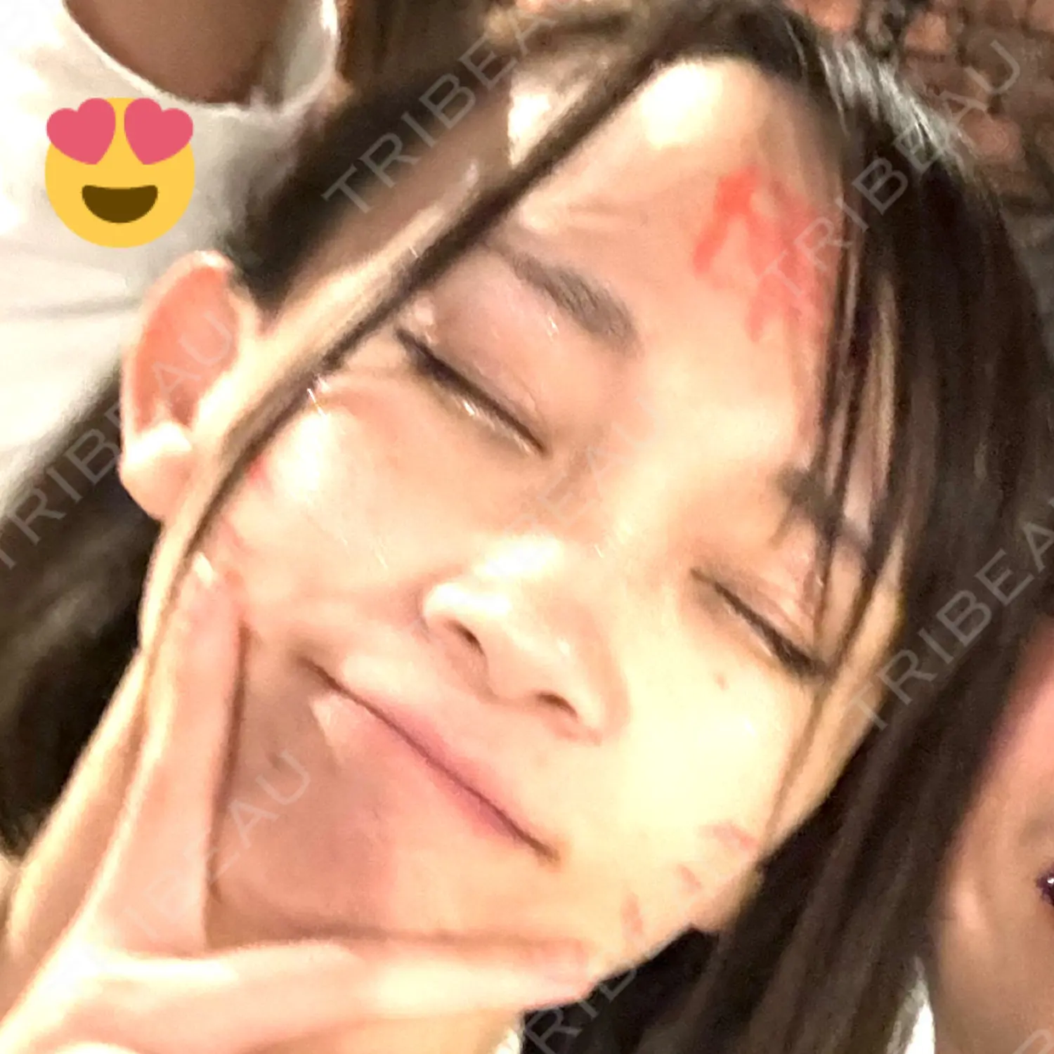 施術前の写真
