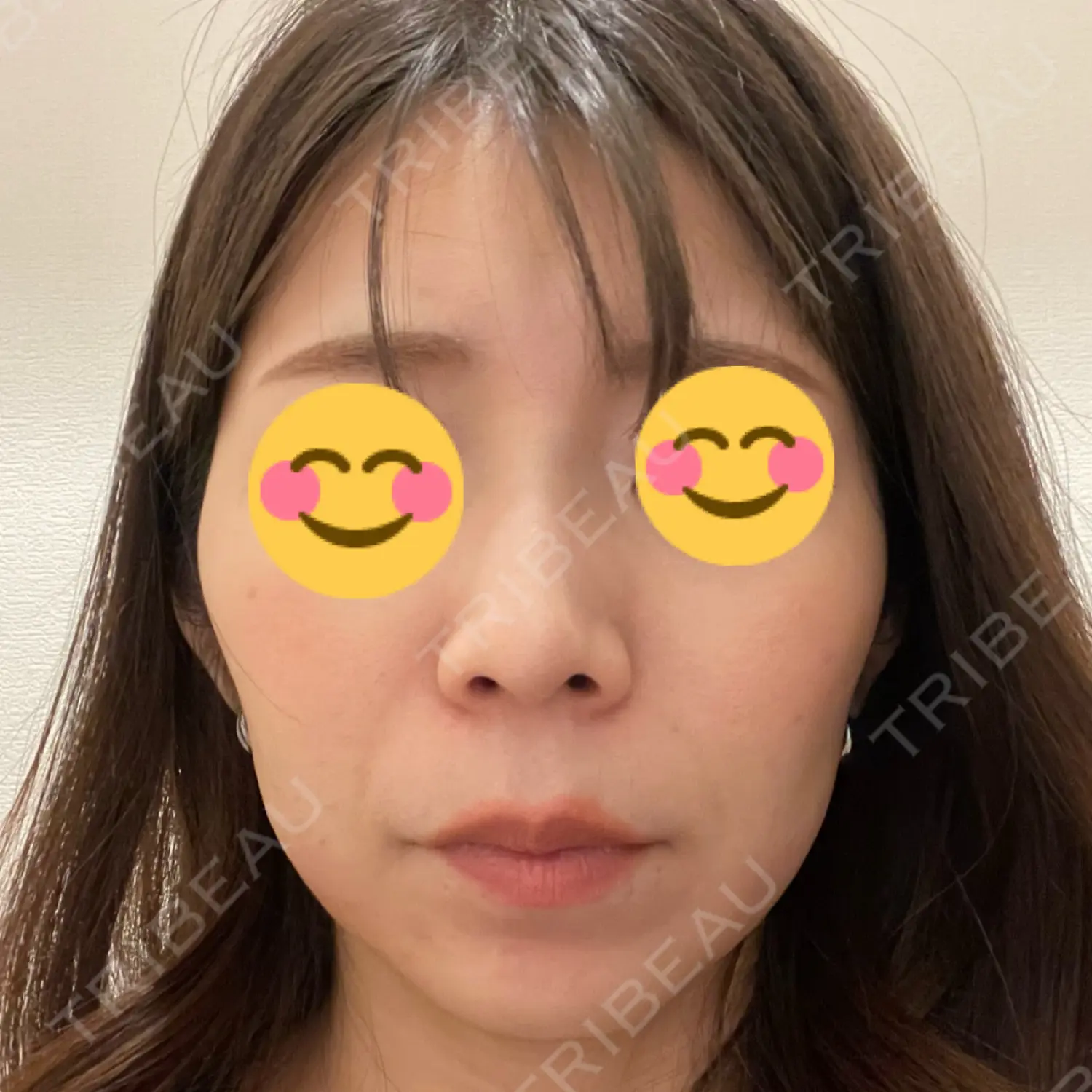 施術前の写真