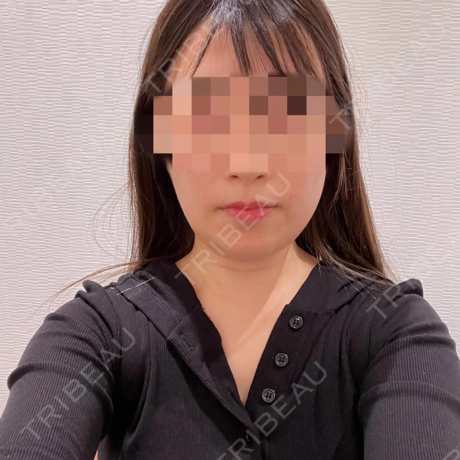 施術前の写真