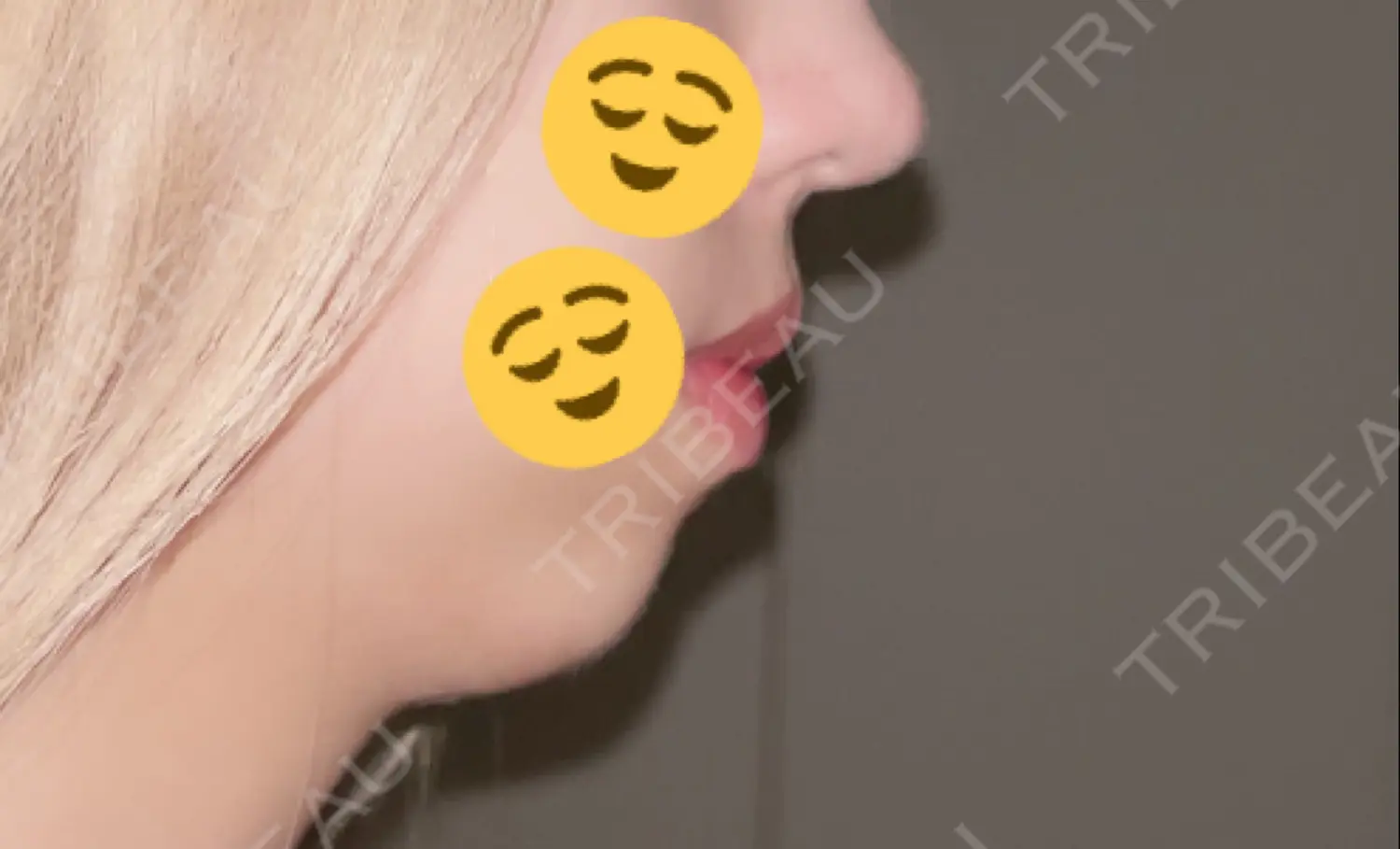 施術前の写真