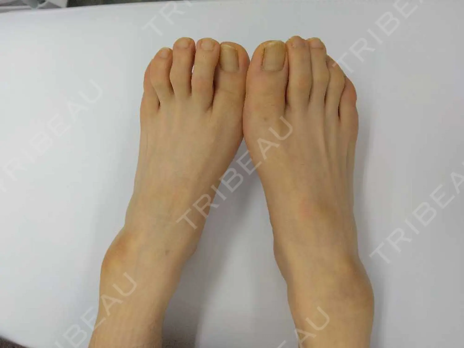 施術前の写真