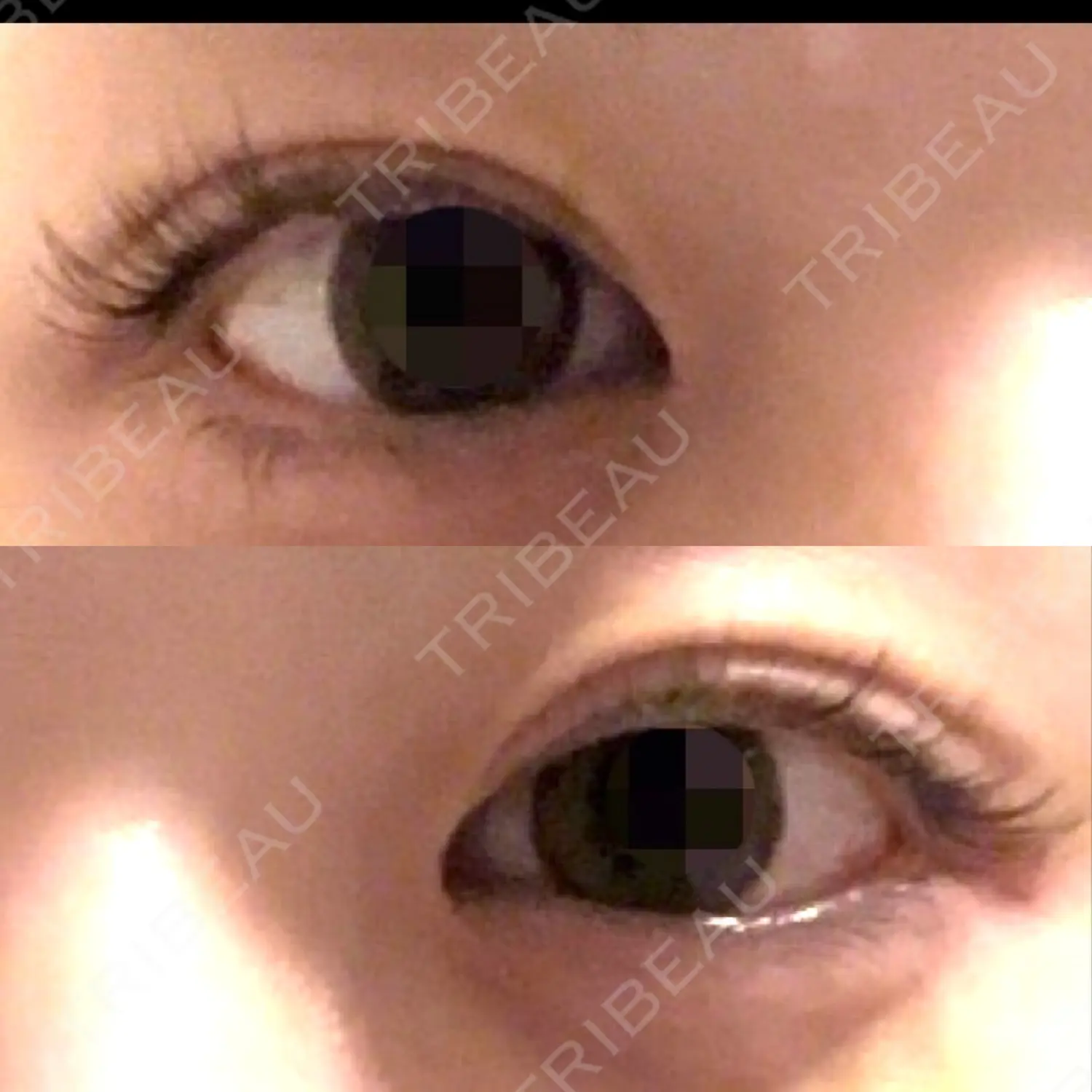 施術前の写真