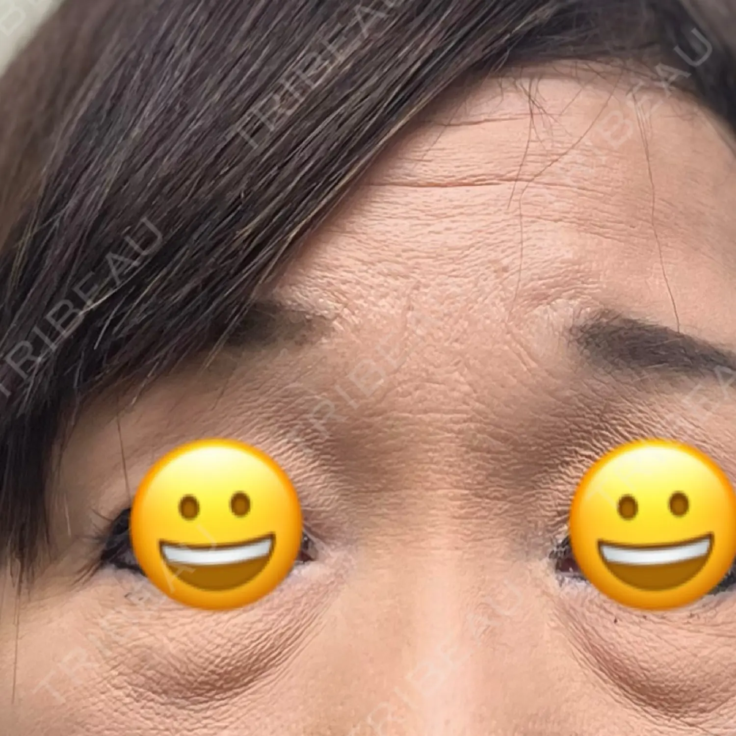 施術前の写真