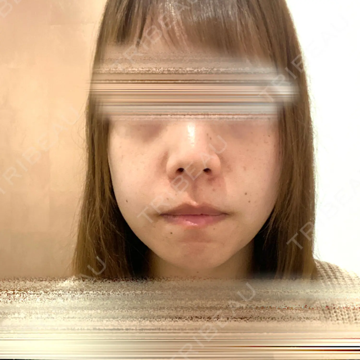 施術前の写真