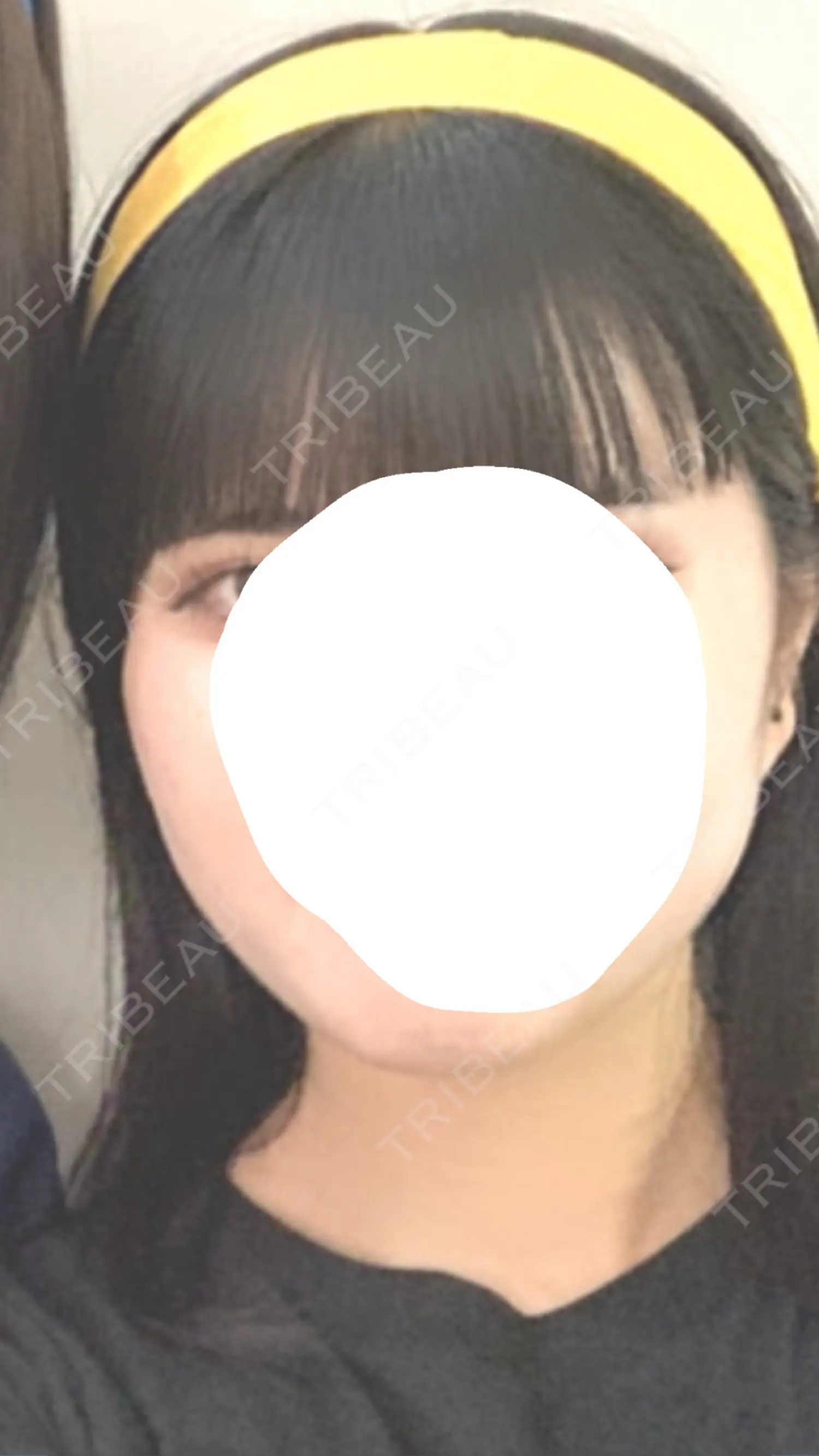 施術前の写真