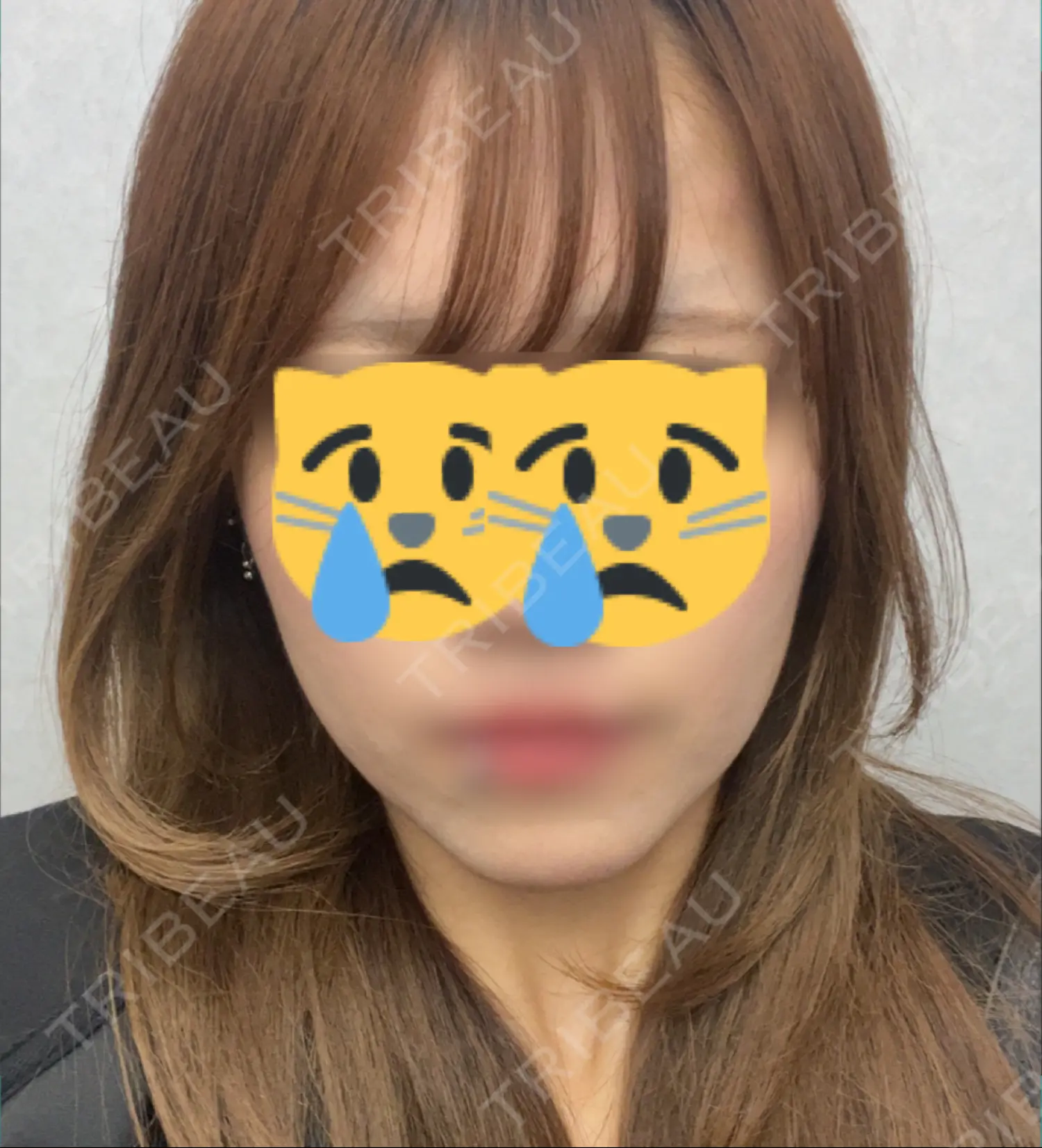 施術前の写真