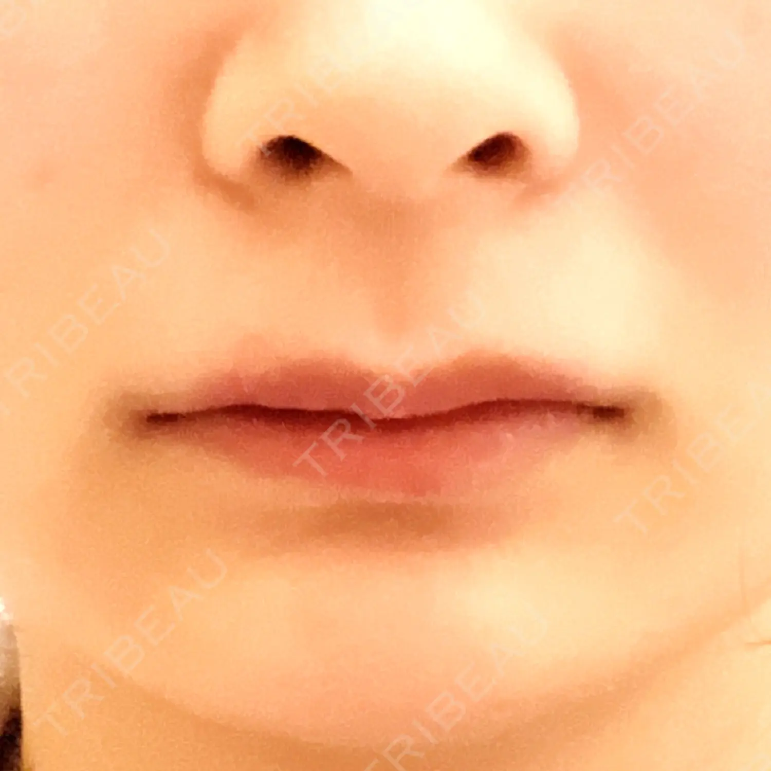 施術前の写真
