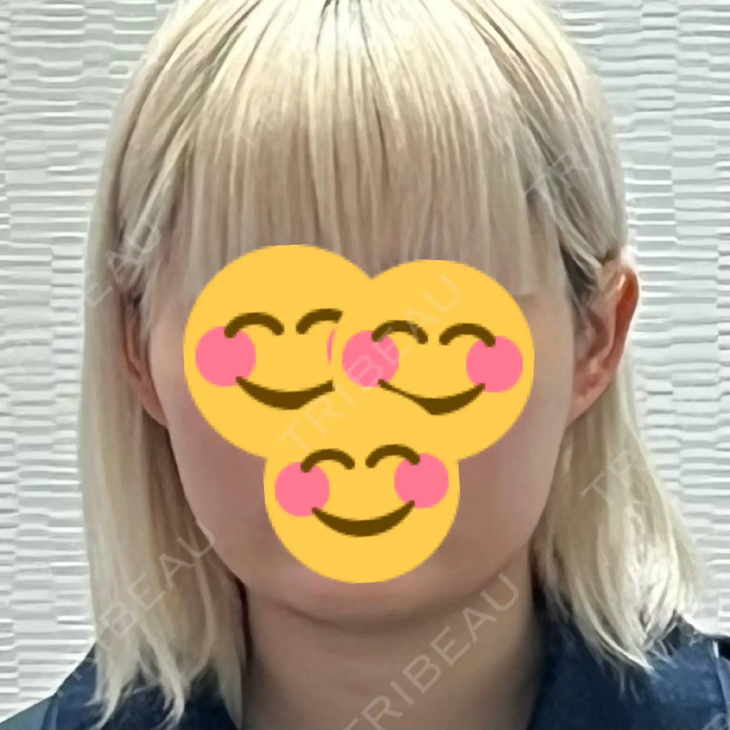 施術前の写真
