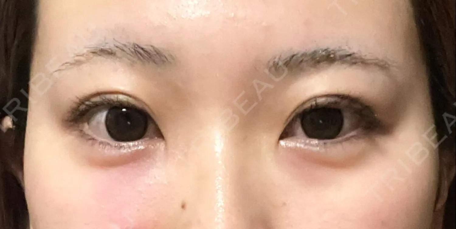 施術前の写真
