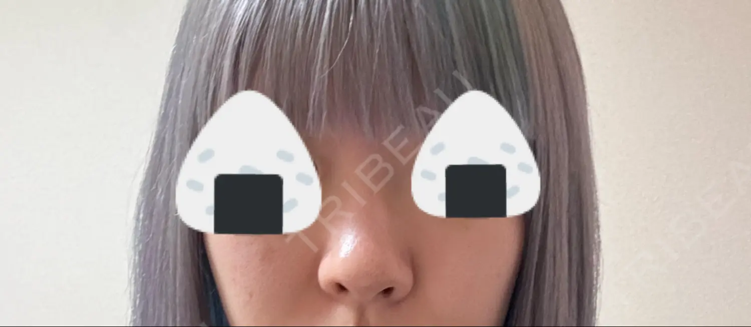 施術前の写真