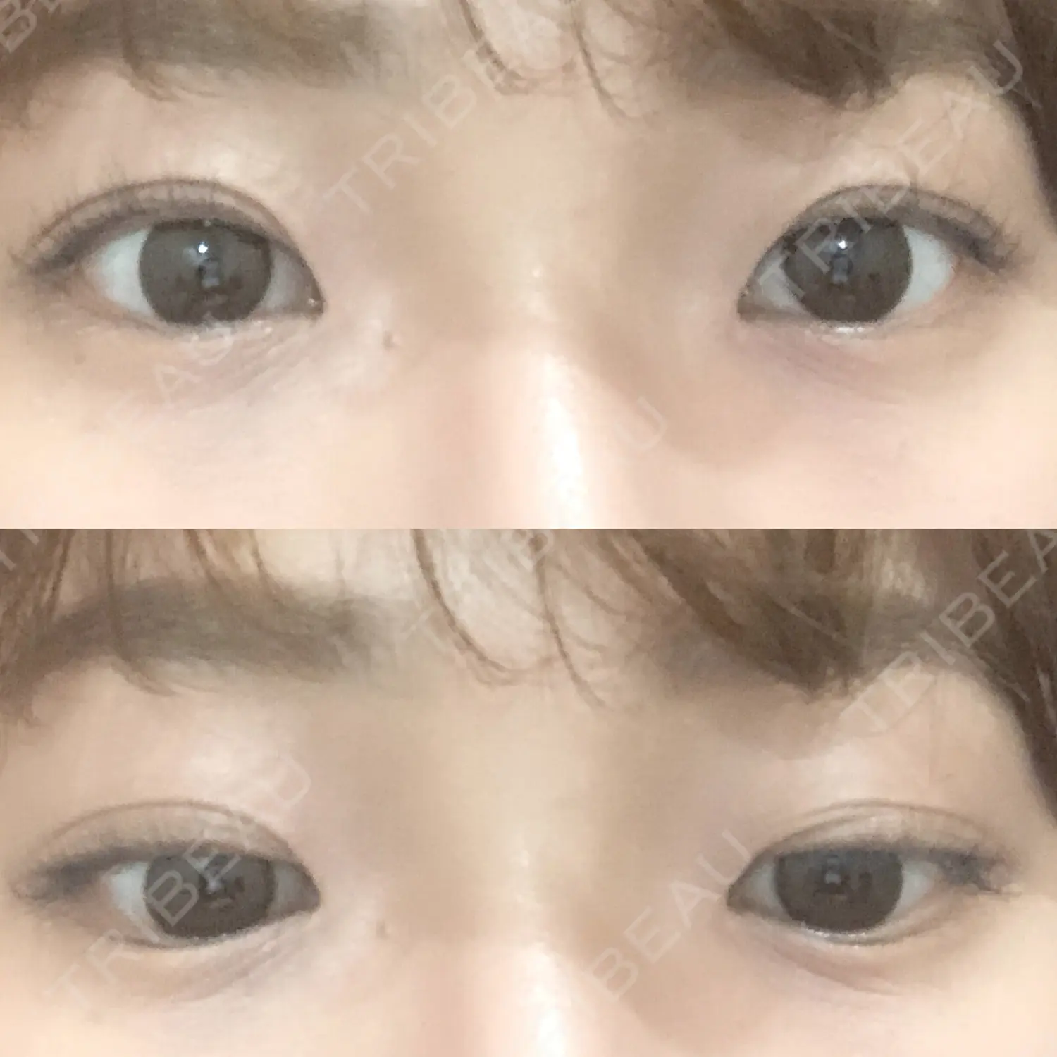 施術前の写真