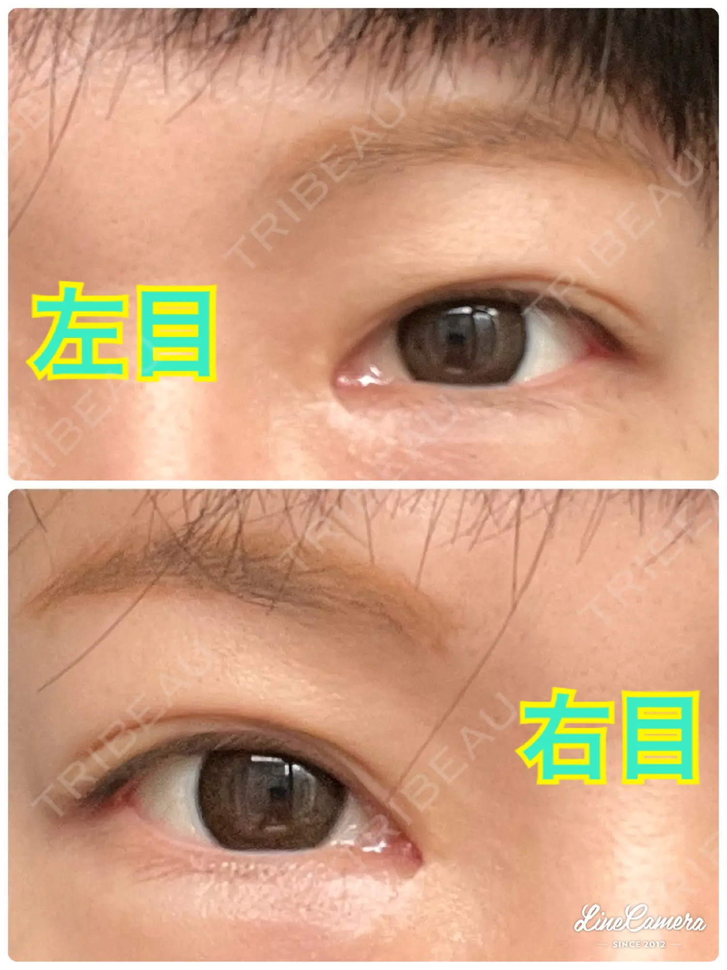 施術前の写真