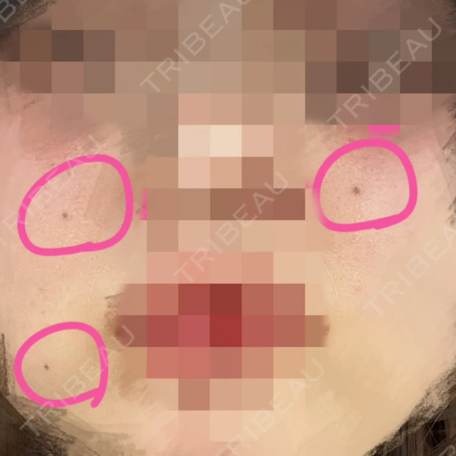 施術前の写真