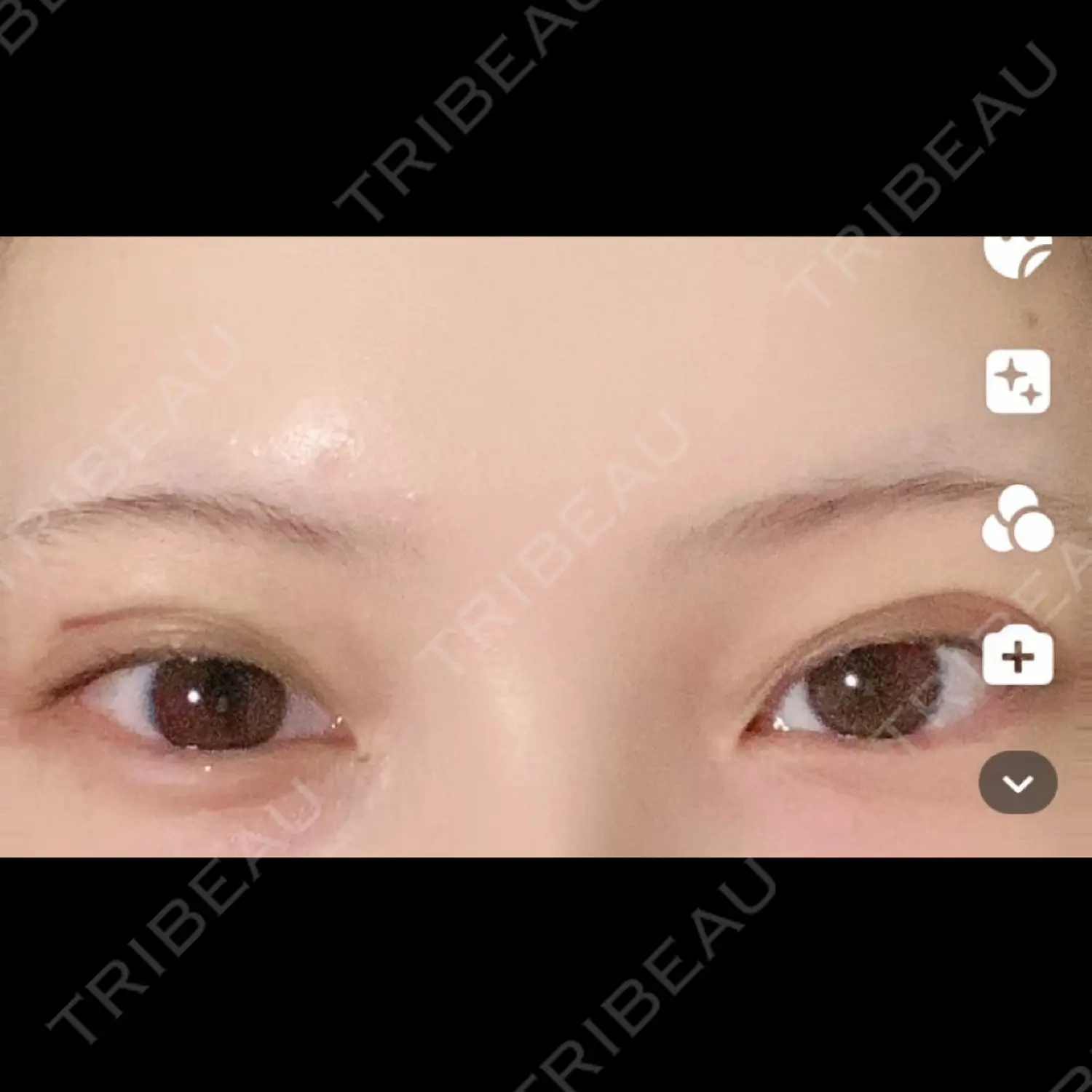 施術前の写真