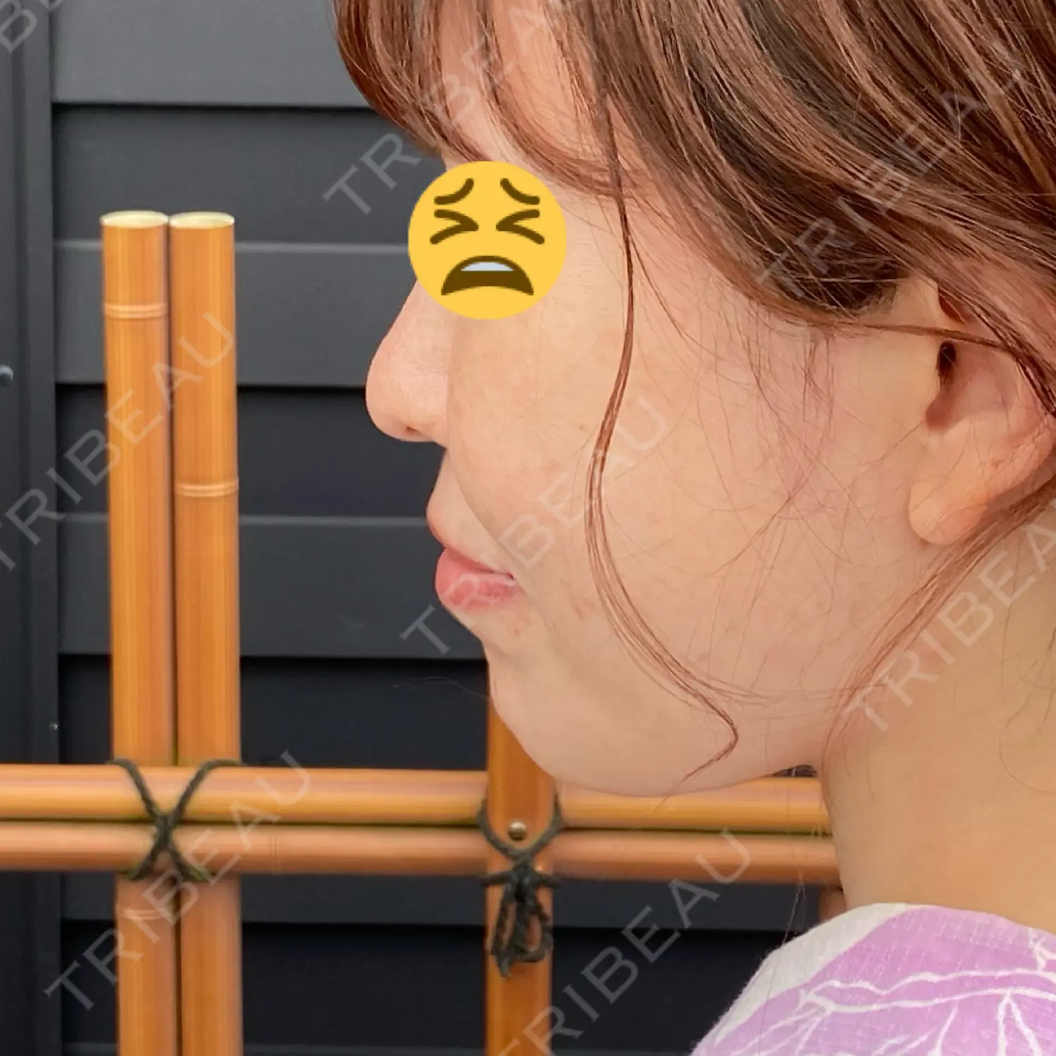 施術前の写真