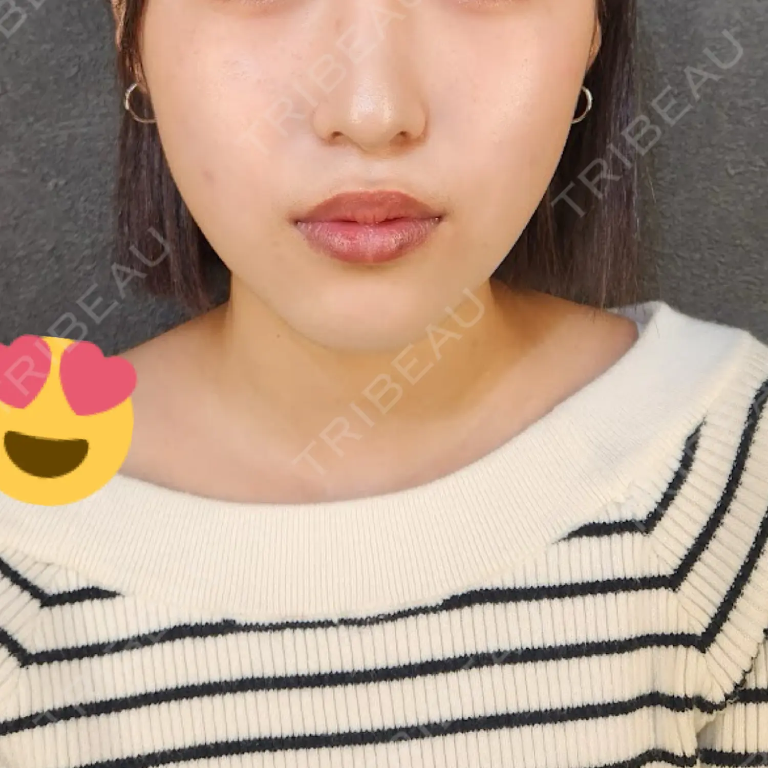 施術前の写真