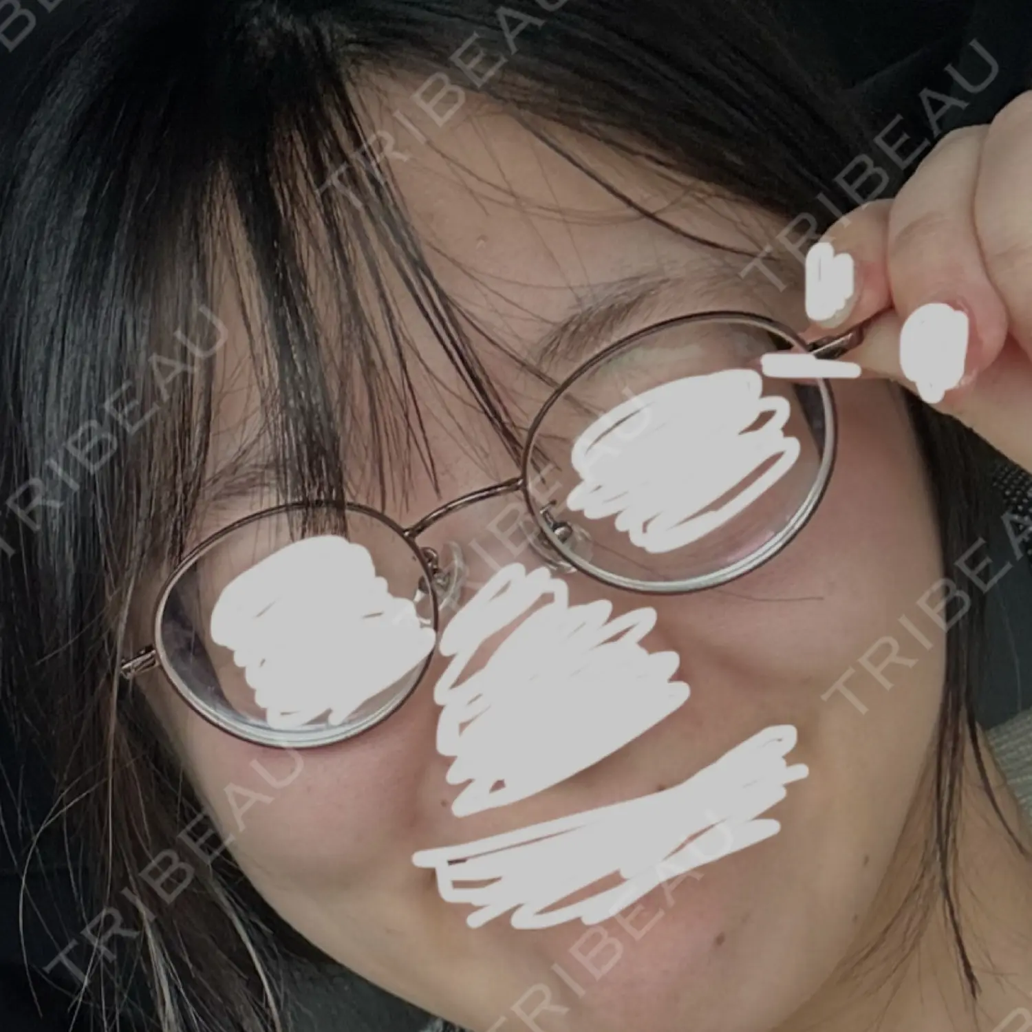 施術前の写真