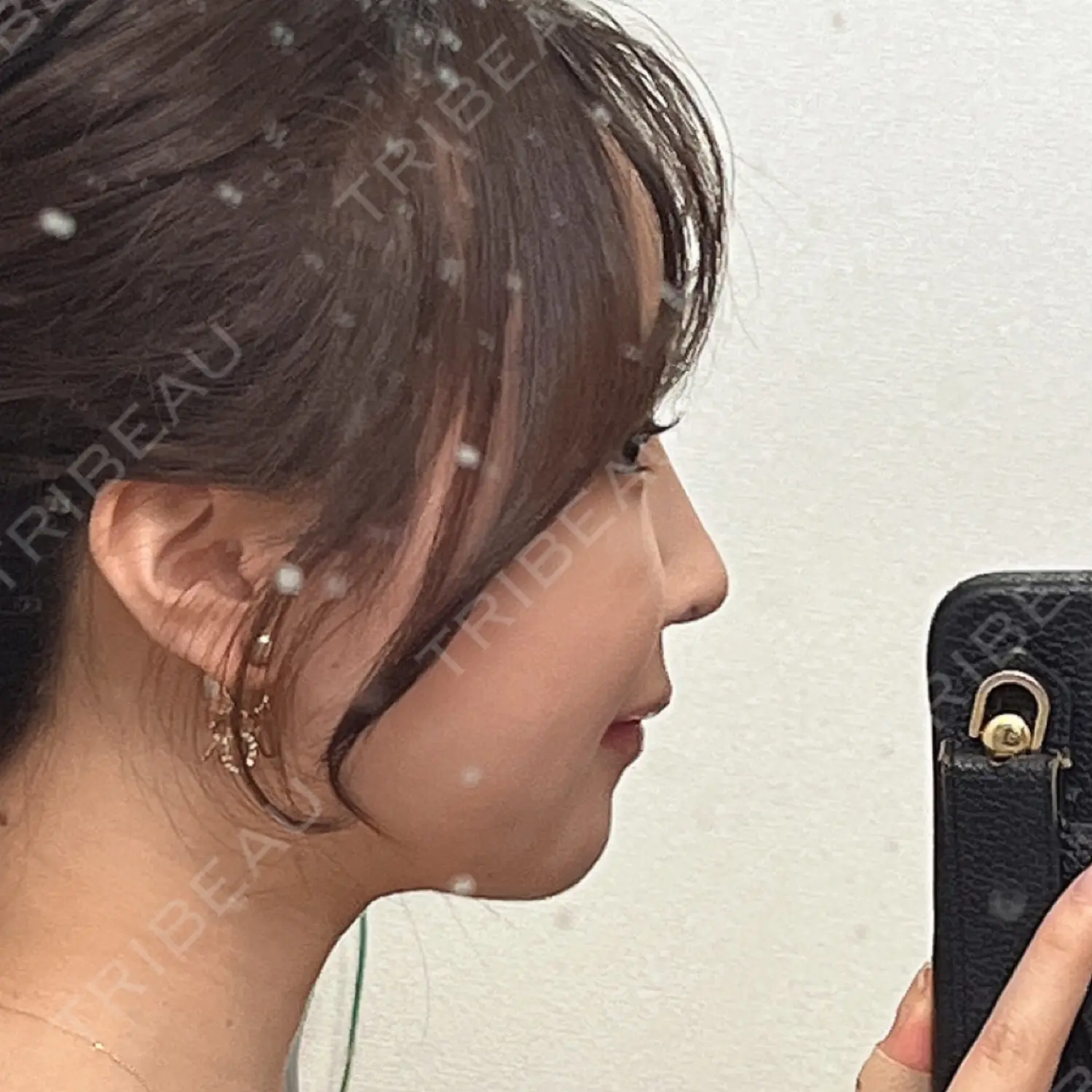 施術前の写真