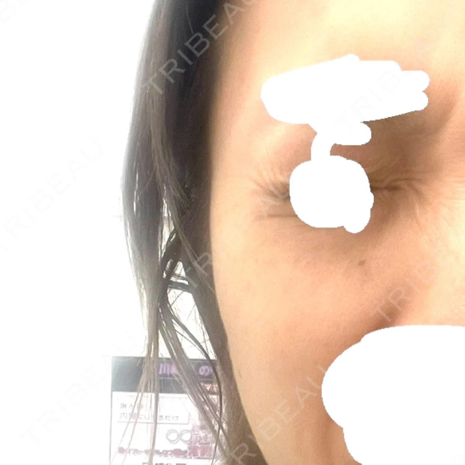施術前の写真